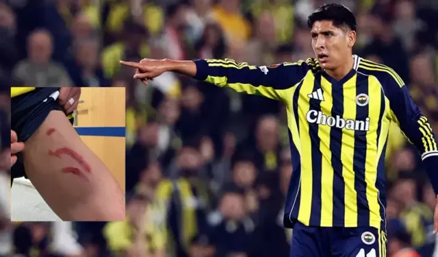 Edson Alvarez’in Sakatlığında Son Durum! Stuttgart Maçının Ardından Açıkladı